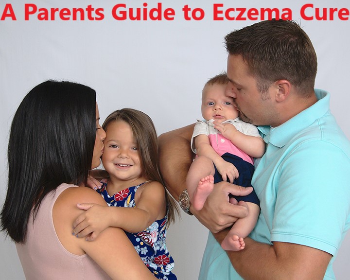 A Parents Guide to Eczema Cure
